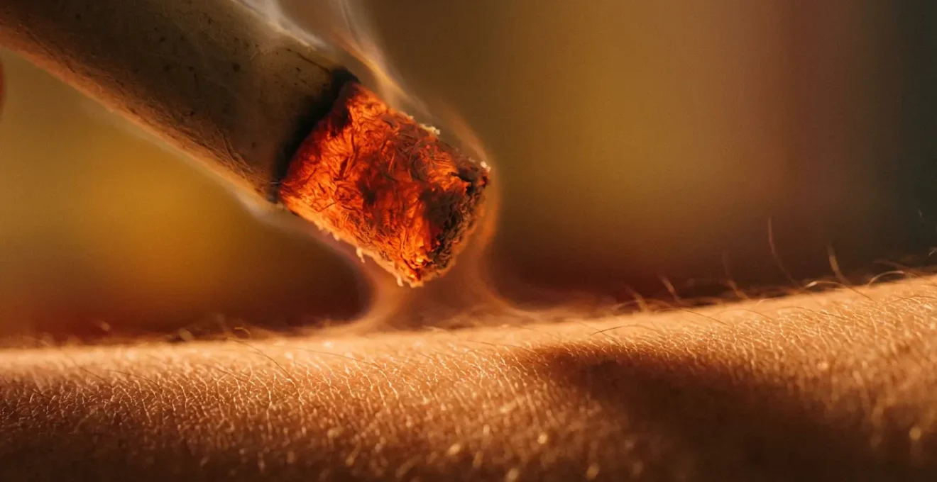 Sigaro di moxa acceso che riscalda delicatamente un punto vitale durante un trattamento invernale